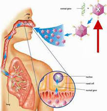 Ảnh 4 của Viêm phổi cấp do vi khuẩn Legionella